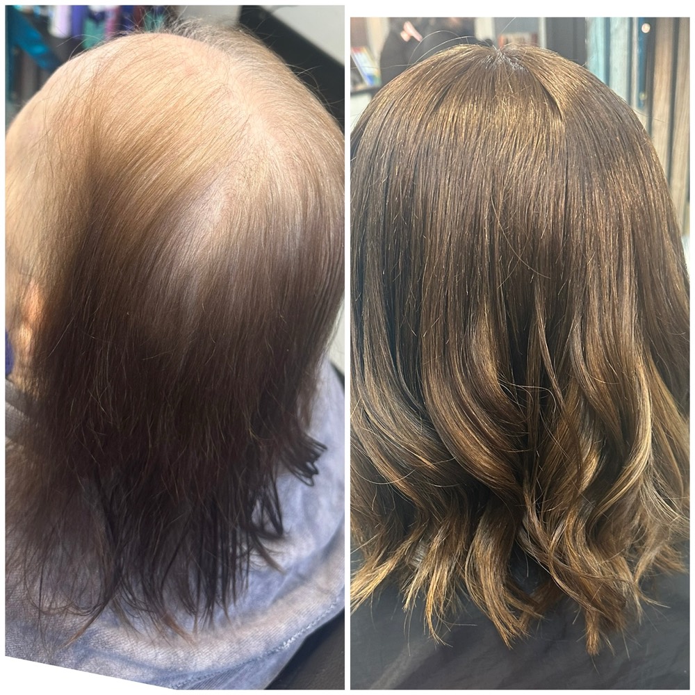 A client's crown photographed before treatment showing diffuse thinning, alongside a later photograph showing denser coverage